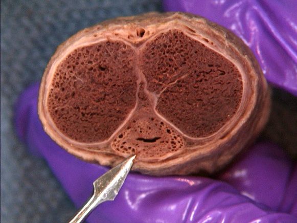 الت تناسلی مرد